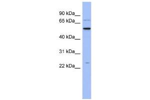 WB Suggested Anti-ZCRB1 Antibody Titration:  0. (ZCRB1 抗体  (N-Term))