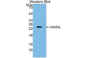 Western Blotting (WB) image for anti-Aggrecan (ACAN) (AA 2163-2316) antibody (ABIN1175194) (Aggrecan 抗体  (AA 2163-2316))