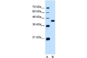 SLC14A1 antibody used at 0. (SLC14A1 抗体  (C-Term))