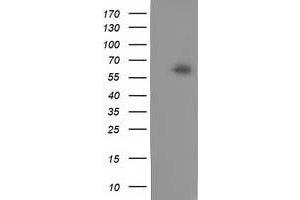 Western Blotting (WB) image for anti-Calcium Binding and Coiled-Coil Domain 2 (CALCOCO2) antibody (ABIN1497076) (CALCOCO2 抗体)
