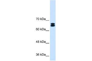 WB Suggested Anti-SLC9A9 Antibody Titration:  0.