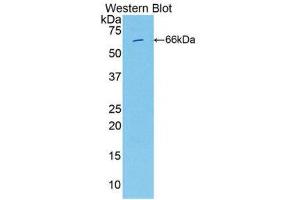 Western Blotting (WB) image for anti-Integrin beta 2 (ITGB2) (AA 451-627) antibody (ABIN1859503) (Integrin beta 2 抗体  (AA 451-627))