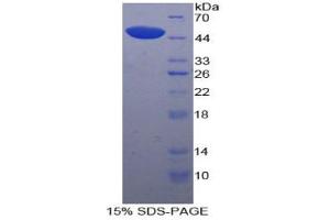 SDS-PAGE analysis of Dog Lp-PLA2 Protein. (PLA2G7 蛋白)