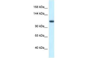 Western Blot showing Mcm10 antibody used at a concentration of 1. (MCM10 抗体  (N-Term))