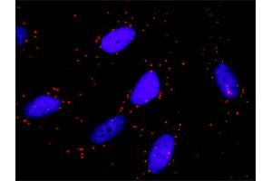 Proximity Ligation Analysis of protein-protein interactions between TRAF4 and TRAF6. (TRAF4 抗体  (AA 1-470))