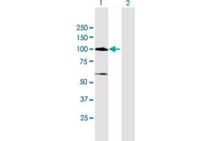 Western Blot analysis of MCC expression in transfected 293T cell line by MCC MaxPab polyclonal antibody. (MCC 抗体  (AA 1-829))