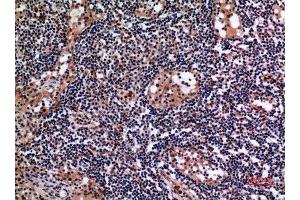 Immunohistochemistry (IHC) analysis of paraffin-embedded Human Lymph Gland, antibody was diluted at 1:100. (Cytokeratin 19 抗体  (C-Term))