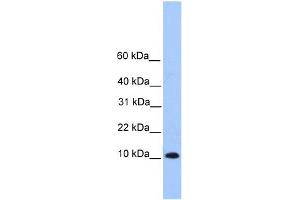 WB Suggested Anti-TRAPPC6B Antibody Titration: 0. (TRAPPC6B 抗体  (Middle Region))