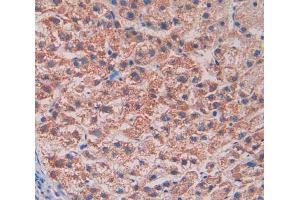 Used in DAB staining on fromalin fixed paraffin- embedded liver tissue (Reelin 抗体  (AA 3142-3460))