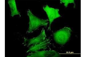 Immunofluorescence of purified MaxPab antibody to ZYX on HeLa cell. (ZYX 抗体  (AA 1-572))