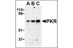 Western blot analysis of PKR in A431 whole cell lysate with this product at (A) 0. (EIF2AK2 抗体  (C-Term))