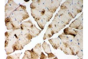 Immunohistochemistry (IHC) image for anti-ATPase, Ca++ Transporting, Cardiac Muscle, Fast Twitch 1 (ATP2A1) (N-Term) antibody (ABIN3030066)