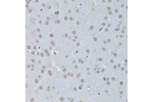 Immunohistochemistry (Paraffin-embedded Sections) (IHC (p)) image for anti-cAMP Responsive Element Binding Protein 1 (CREB1) antibody (ABIN3021674)