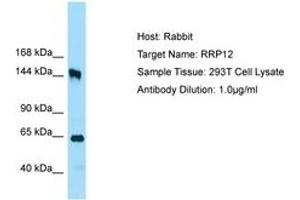 Image no. 1 for anti-Ribosomal RNA Processing 12 Homolog (RRP12) (AA 1126-1175) antibody (ABIN6750070) (RRP12 抗体  (AA 1126-1175))