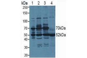 Western blot analysis of (1) Human 293T cells, (2) Human HeLa cells, (3) Human HepG2 cells and (4) Human Saliva Tissue. (PSMC3 抗体  (AA 2-439))