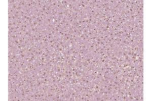 Immunohistochemistry (Paraffin-embedded Sections) (IHC (p)) image for anti-Keratin 18 (KRT18) (pSer60) antibody (ABIN801588)