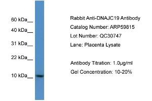 WB Suggested Anti-DNAJC19  Antibody Titration: 0. (DNAJC19 抗体  (C-Term))