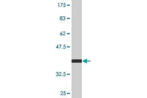 Western Blot detection against Immunogen (38. (CARTPT 抗体  (AA 1-116))