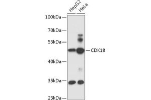 Western blot analysis of extracts of various cell lines, using CDK18 antibody (ABIN7266581) at 1:1000 dilution. (CDK18 抗体  (AA 373-474))