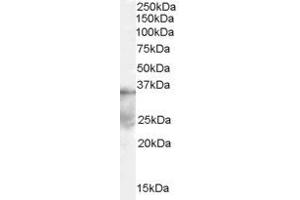 Western Blotting (WB) image for anti-Autophagy related 4A Cysteine Peptidase (ATG4A) (Middle Region) antibody (ABIN2787881) (ATG4A 抗体  (Middle Region))