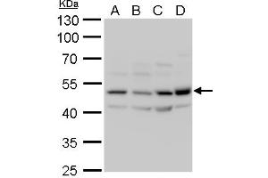 Western Blotting (WB) image for anti-Calcium/calmodulin-Dependent Protein Kinase II delta (CAMK2D) antibody (ABIN2856806)
