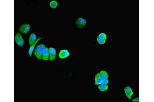 Immunofluorescent analysis of MCF-7 cells using ABIN7162688 at dilution of 1:100 and Alexa Fluor 488-congugated AffiniPure Goat Anti-Rabbit IgG(H+L) (PNPLA1 抗体  (AA 101-300))