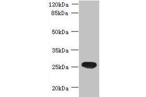 Western blot All lanes: ENKD1 antibody at 7 μg/mL + Mouse brain tissue Secondary Goat polyclonal to rabbit IgG at 1/10000 dilution Predicted band size: 39, 26 kDa Observed band size: 26 kDa (ENKD1 抗体  (AA 1-346))