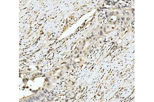 IHC analysis of EXOSC8 using anti-EXOSC8 antibody (ABIN7601850).