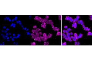 Immunocytochemical staining of HAP-1 cells with CD10 antibody (ABIN7799366), 1:1,000). (Recombinant MME 抗体)