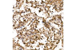 Immunohistochemistry of paraffin-embedded Human testicular seminoma using NY-ESO-1 Rabbit pAb (ABIN6131864, ABIN6143238, ABIN6143239 and ABIN6221674) at dilution of 1:200 (40x lens). (LIN28A 抗体  (AA 142-209))