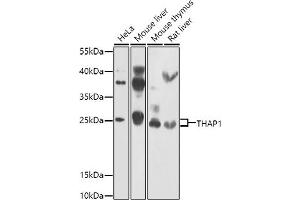Western blot analysis of extracts of various cell lines, using TH antibody (ABIN6128823, ABIN6149105, ABIN6149106 and ABIN6223361) at 1:1000 dilution. (THAP1 抗体  (AA 1-213))