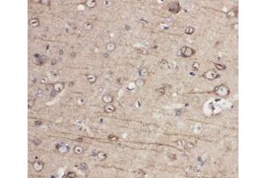 IHC-P: EphA1 antibody testing of rat brain tissue