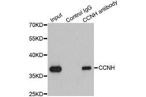 Immunoprecipitation (IP) image for anti-Cyclin H (CCNH) (AA 1-323) antibody (ABIN3021259)