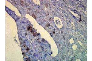 Image no. 1 for anti-Heat Shock Protein 70 (HSP70) (AA 436-503) antibody (ABIN466875) (HSP70 抗体  (AA 436-503))