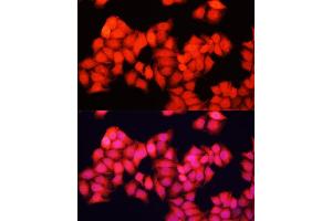 Immunofluorescence analysis of HeLa cells using ARAF antibody  at dilution of 1:100. (ARAF 抗体  (AA 371-606))