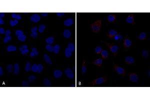 Immunocytochemistry/Immunofluorescence analysis using Mouse Anti-VPS35 Monoclonal Antibody, Clone 10A8 (ABIN6932981). (VPS35 抗体  (Atto 390))