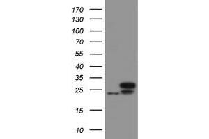 Image no. 1 for anti-Ubiquitin-Conjugating Enzyme E2E 3 (UBE2E3) antibody (ABIN1501625) (UBE2E3 抗体)