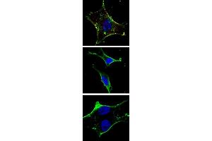 Immunofluorescence (IF) image for anti-Mast/stem Cell Growth Factor Receptor (KIT) antibody (ABIN1882197)