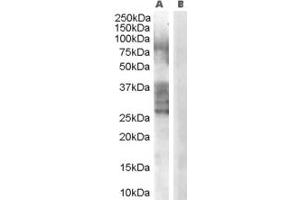 Western Blotting (WB) image for anti-Breast Carcinoma Amplified Sequence 1 (BCAS1) (C-Term) antibody (ABIN2790141) (BCAS1 抗体  (C-Term))