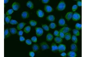 IF analysis of ZC3H7A using anti-ZC3H7A antibody (ABIN7599946).