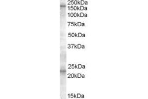 Image no. 1 for anti-ATP-Binding Cassette, Sub-Family C (CFTR/MRP), Member 8 (ABCC8) (C-Term) antibody (ABIN334499)