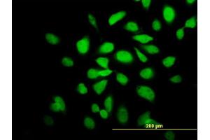 Immunofluorescence of monoclonal antibody to CAMK2A on HeLa cell. (CAMK2A 抗体  (AA 305-410))