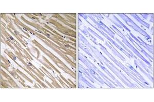 Immunohistochemistry analysis of paraffin-embedded human heart tissue, using NDRG4 Antibody. (NDRG4 抗体  (AA 187-236))