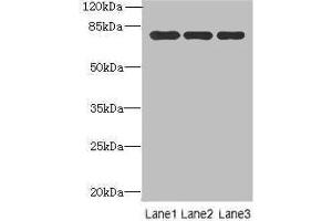 Western blot All lanes: Xaa-Pro aminopeptidase 1 antibody at 8 μg/mL Lane 1: Mouse small intestine tissue Lane 2: Mouse stomach tissue Lane 3: Mouse kidney tissue Secondary Goat polyclonal to rabbit IgG at 1/10000 dilution Predicted band size: 70, 68, 75, 73 kDa Observed band size: 70 kDa (XPNPEP1 抗体  (AA 2-623))