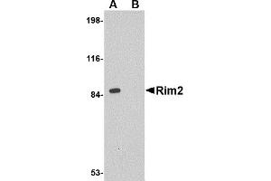 Western Blotting (WB) image for anti-Regulating Synaptic Membrane Exocytosis 2 (RIMS2) (Middle Region) antibody (ABIN1031067) (RIMS2 抗体  (Middle Region))