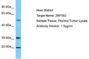 Host: Rabbit Target Name: ZNF562 Sample Tissue: Human Thymus Tumor Antibody Dilution: 1ug/ml (ZNF562 抗体  (C-Term))