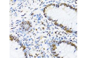 Immunohistochemistry (Paraffin-embedded Sections) (IHC (p)) image for anti-DEAD (Asp-Glu-Ala-Asp) Box Polypeptide 39B (DDX39B) antibody (ABIN7264385)