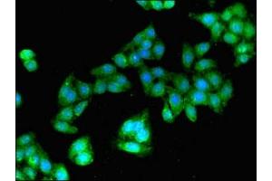 Immunofluorescent analysis of HepG2 cells using ABIN7154773 at dilution of 1:100 and Alexa Fluor 488-congugated AffiniPure Goat Anti-Rabbit IgG(H+L) (GBP2 抗体  (AA 100-259))