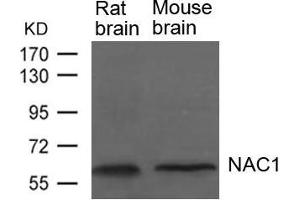 Western blot analysis of extracts from Rat and Mouse brain tissue using NAC1 Antibody. (NAC1 抗体)