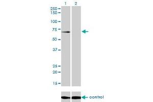 Western blot analysis of GALNT6 over-expressed 293 cell line, cotransfected with GALNT6 Validated Chimera RNAi (Lane 2) or non-transfected control (Lane 1). (GALNT6 抗体  (AA 523-622))